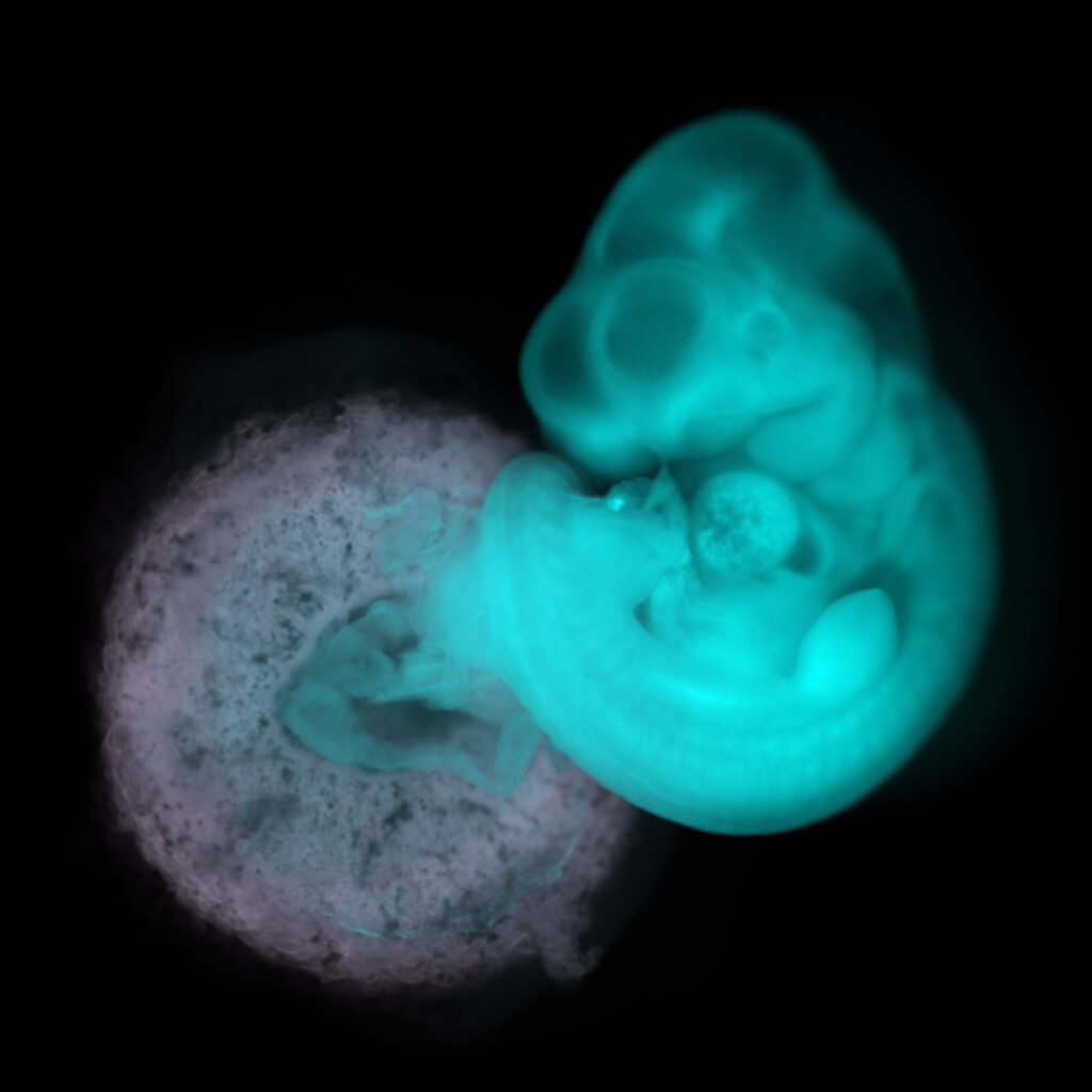Mouse embryo (blue) and placenta (white) Mouse embryo (blue) and placenta (white)